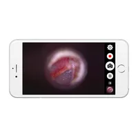 Podgląd obrazu z wideootoskopu Firefly w aplikacji na iOS
